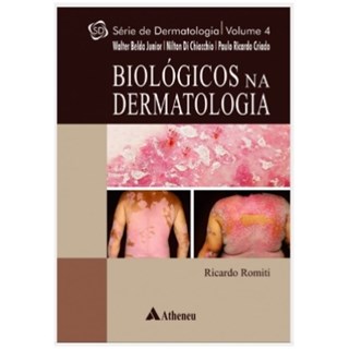 Livro - Biológicos na Dermatologia - Romiti