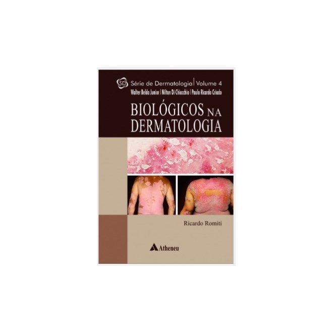 Livro - Biologicos Na Dermatologia - Vol. 4 - Romiti/belda Junior/