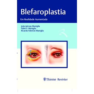 Livro Blefaroplastia - Maniglia - Revinter