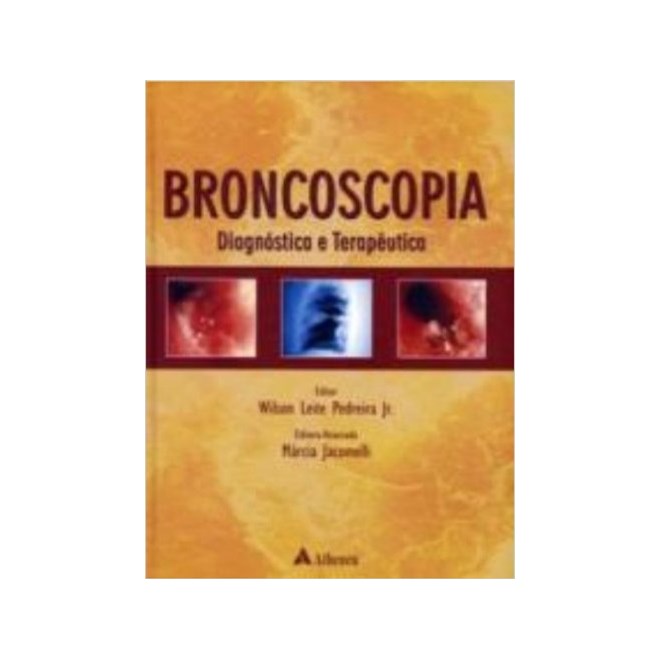 Livro - Broncoscopia - Diagnostica e Terapeutica - Pedreira Jr. (ed.)