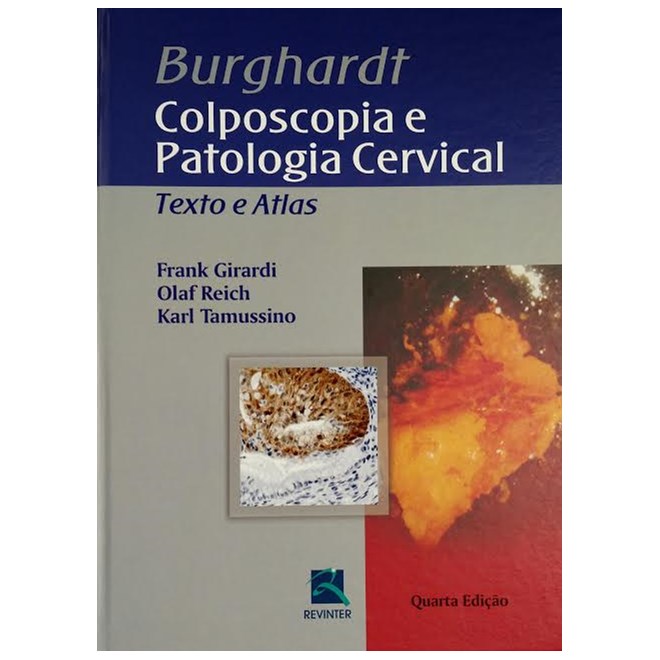 Livro - Burghardt. Colposcopia e Patologia Cervical - Girardi/reich/tamuss