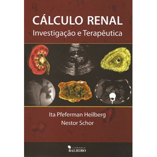 Livro - Calculo Renal - Investigaçao e terapeutica