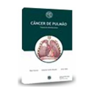 Livro - Câncer de Pulmão - TMC - Hospital Sírio Libânes Livro - Câncer de Pulmão - TMC - Hospital Sírio Libânes