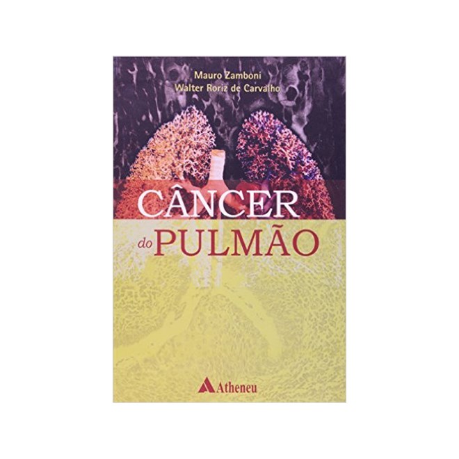 Livro - Cancer do Pulmao - Zamboni /carvalho