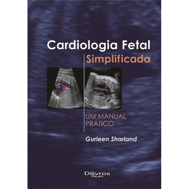 Livro Cardiologia Fetal Simplificada: Um Manual Pratico - Sharland
