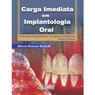 Livro - Carga Imediata em Implantologia Oral - Berchelli Livro - Carga Imediata em Implantologia Oral - Berchelli