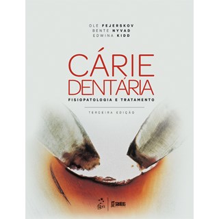 Livro - Carie Dentaria: Fisiopatologia e Tratamento - Fejerskov/nyvad/kidd