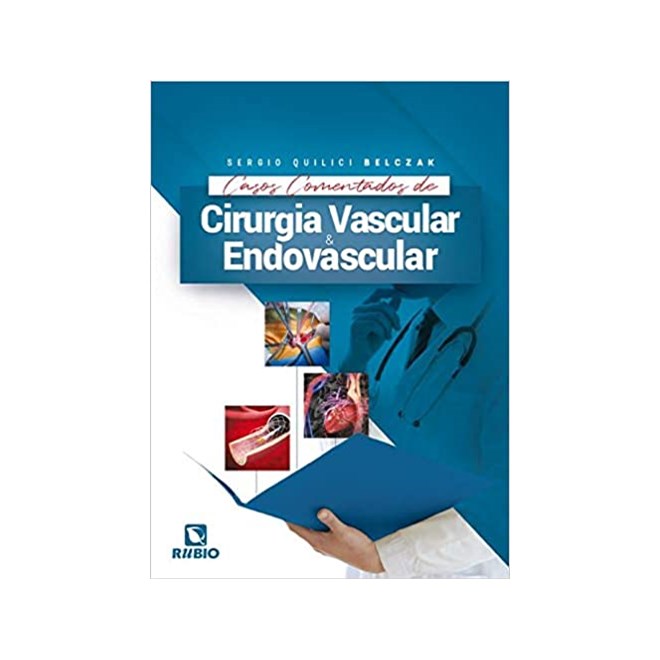 Livro Casos Comentados de Cirurgia Vascular e Endovascular - Belczak - Rúbio