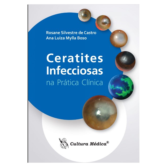 Livro - Ceratites Infecciosas Na Pratica Clinica - Castro/ Boso
