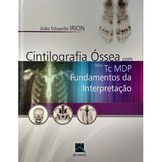 Livro - Cintilografia Ossea com 99m Tc Mdp - Fundamentos da Interpretacao - Irion