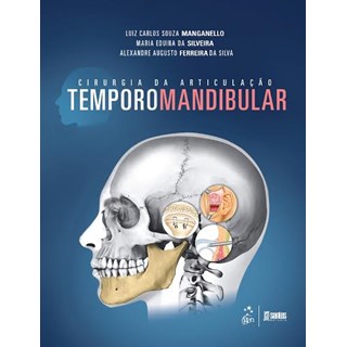 Livro - Cirurgia da Articulação Temporomandibular - Manganello