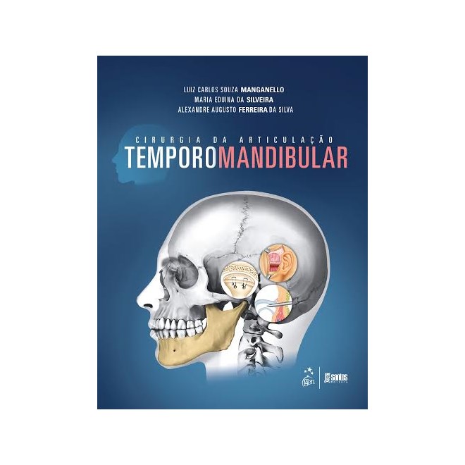 Livro - Cirurgia da Articulacao Temporomandibular - Manganello/silveira