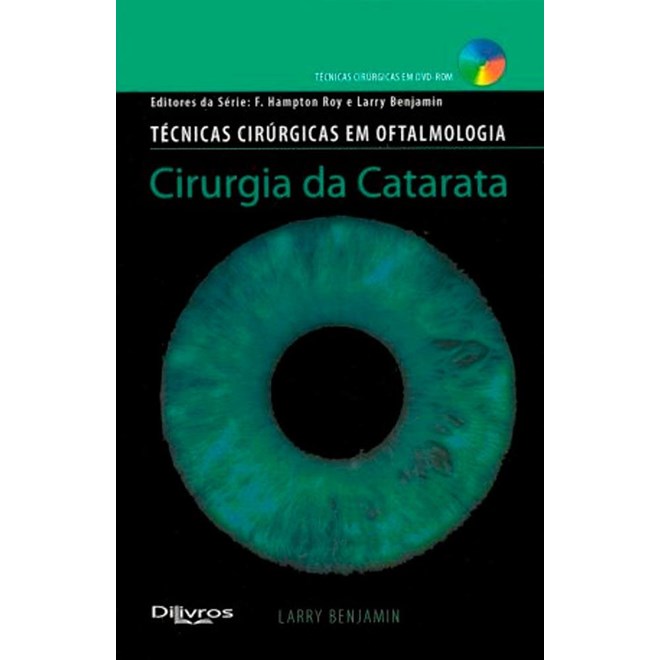 Livro Cirurgia da Catarata - Benjamin - DiLivros