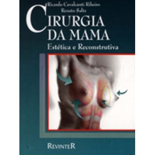 Livro - Cirurgia da Mama - Estética e Reconstrutiva com CD - Pitanguy Livro - Cirurgia da Mama - Estética e Reconstrutiva com CD - Pitanguy