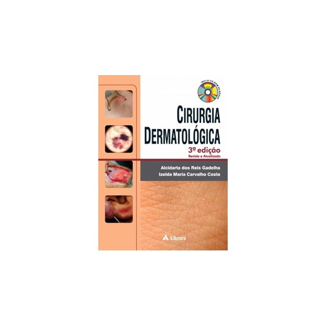 Livro - Cirurgia Dermatologia - Gadelha