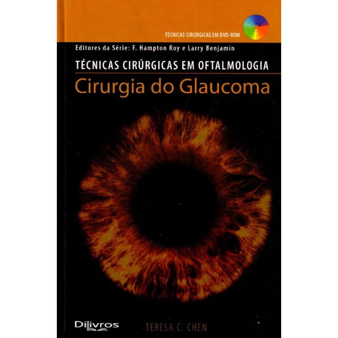 Livro Cirurgia do Glaucoma - Chen - DiLivros