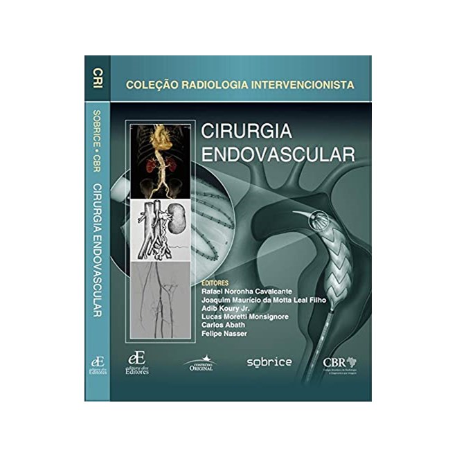 Livro - Cirurgia Endovascular: Colecao Radiologia Intervencionista - Cavalcante/leal Filh