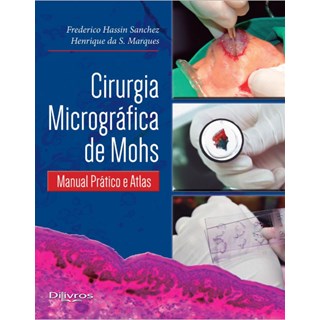 Livro - Cirurgia Micrografia de Mohs - Sanchez/marques