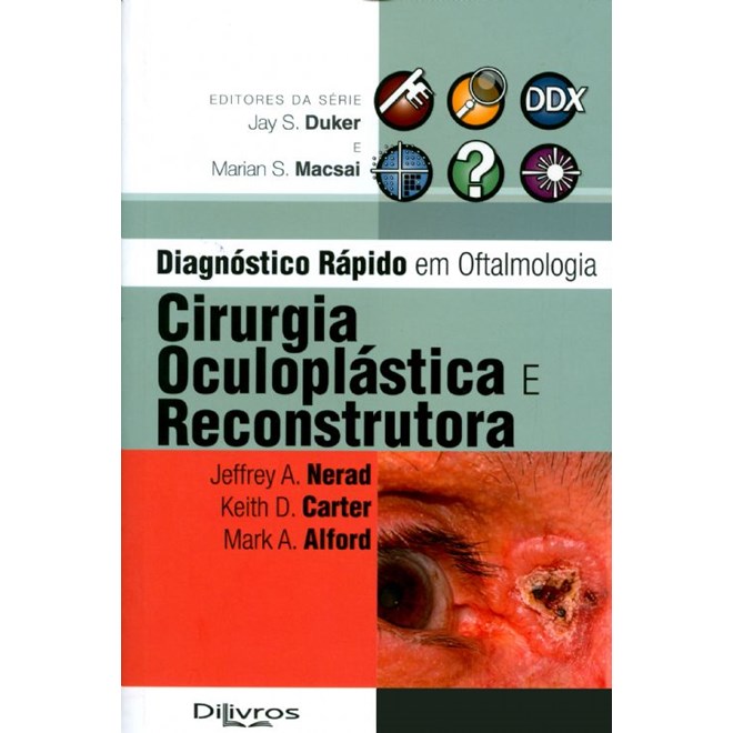 Livro Cirurgia Óculoplastica e Reconstrutora - Nerad - DiLivros