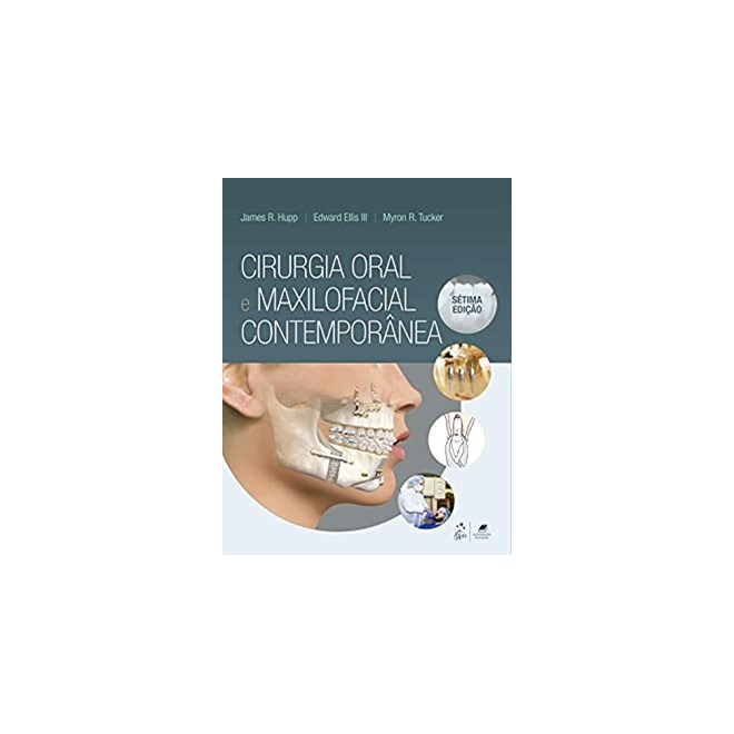 Livro Cirurgia Oral e Maxilofacial Contemporânea - Hupp - Guanabara