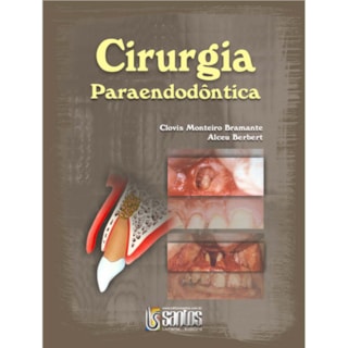 Livro - Cirurgia Paraendodôntica - Bramante Livro - Cirurgia Paraendodôntica - Bramante