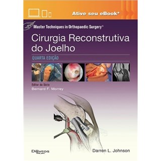 Livro - Cirurgia Reconstrutiva do Joelho: Master Techniques In Orthopaedic Surgery - Johnson