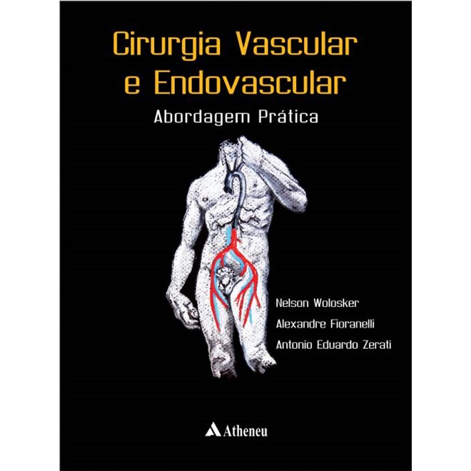 Livro - Cirurgia Vascular e Endovascular - Abordagem Prática - Wolosker