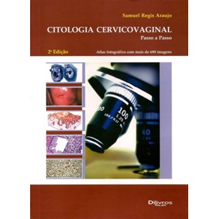 Livro - Citologia Cervicovaginal - Passo a Passo - Araujo