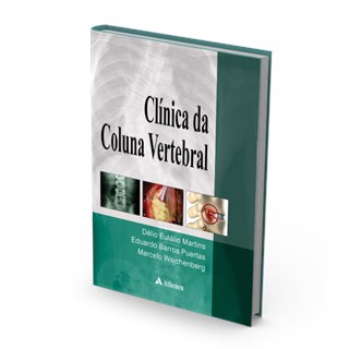 Livro - Clinica da Coluna Vertebral - Martins/puertas/wajc