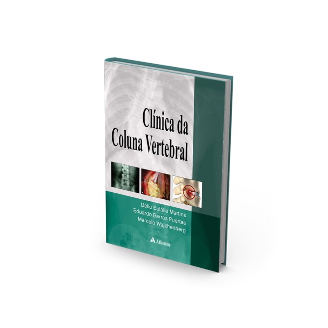 Livro - Clinica da Coluna Vertebral - Martins/puertas/wajc