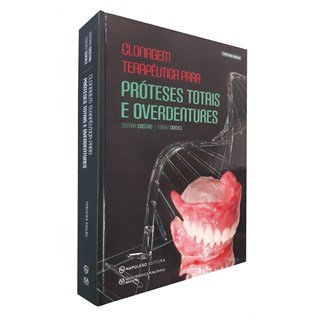 Livro - Clonagem Terapeutica para Proteses Totais e Overdentures - Castro/ Gomes