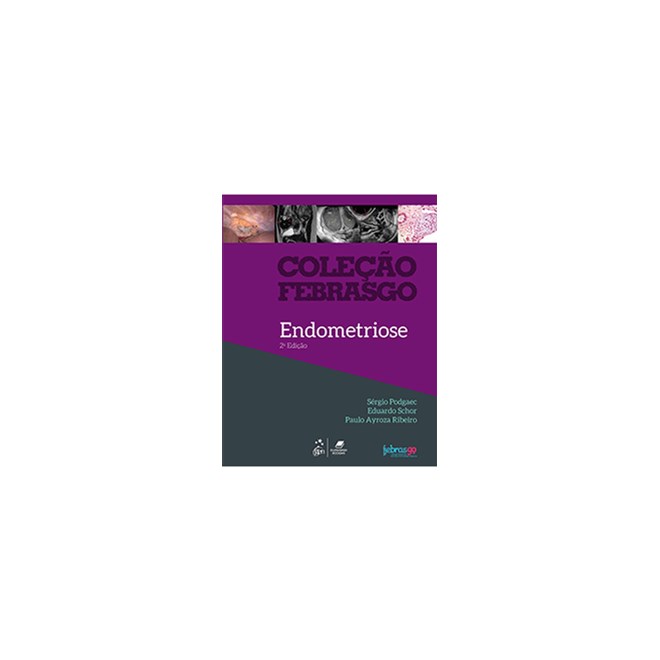 Livro - Colecao Febrasgo - Endometriose - Febrasgo