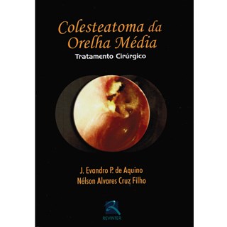 Livro - Colesteatoma da Orelha Media - Tratamento Cirurgico - Aquino/cruz Filho