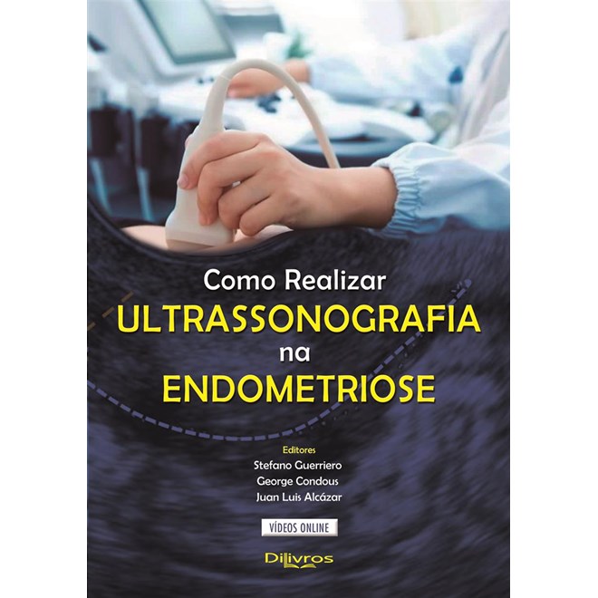 Livro - Como Realizar Ultrassonografia Na Endometriose - Guerriero/condous/al
