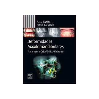 Livro - Deformidades Maxilomandibulares - Tratamento Ortodontico-cirurgico - Canal