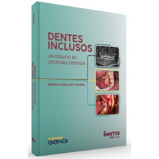 Livro - Dentes Inclusos: Um Desafio ao Cirurgiao-dentista - Teixeira