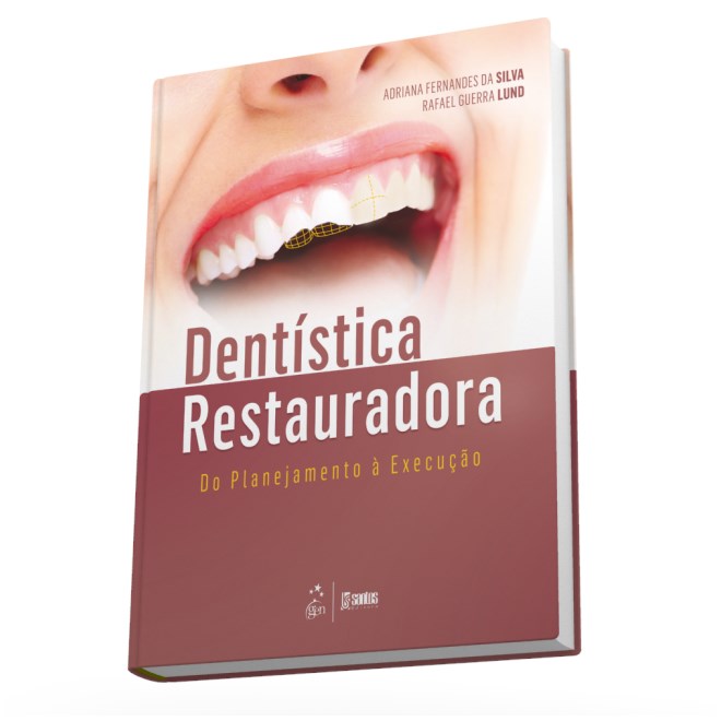 Livro - Dentistica Restauradora - do Planejamento a Execucao - Silva/lund