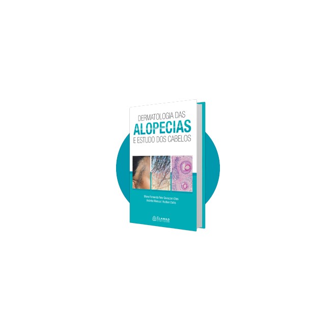 Livro Dermatologia das Alopecias e Estudo dos Cabelos - Dias - Clannad