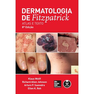 Livro - Dermatologia de Fitzpatrick - Atlas e Texto - Wolff/johnson/aavedr