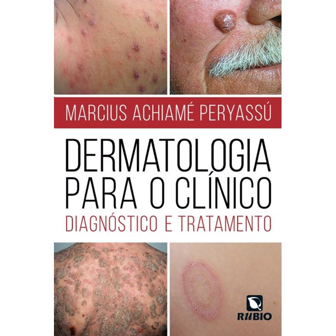 Livro Dermatologia para o Clínico - Diagnóstico e Tratamento - Peryassu - Rúbio