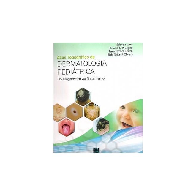 Livro - Dermatologia Pediatrica - do Diagnostico ao Tratamento - Lowy/cestari/oliveir