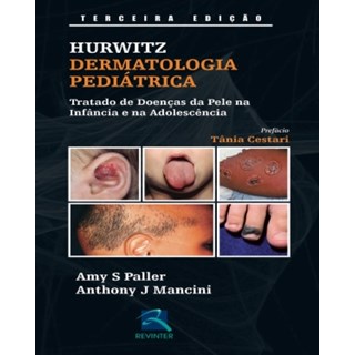 Livro - Dermatologia Pediátrica - Tratado de Doenças da Pele na Infância e na Adolescência - Hurwitz