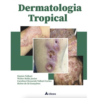 Livro - Dermatologia Tropical - Talhari/belda Junior