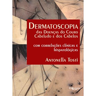 Livro Dermatoscopia das Doenças do Couro Cabeludo e dos Cabelos- Tosti