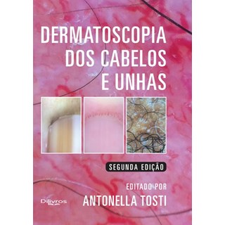 Livro - Dermatoscopia dos Cabelos e Unhas - Tosti