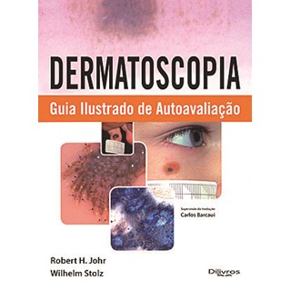 Livro - Dermatoscopia Guia Ilustrado de Autoavaliação - Johr