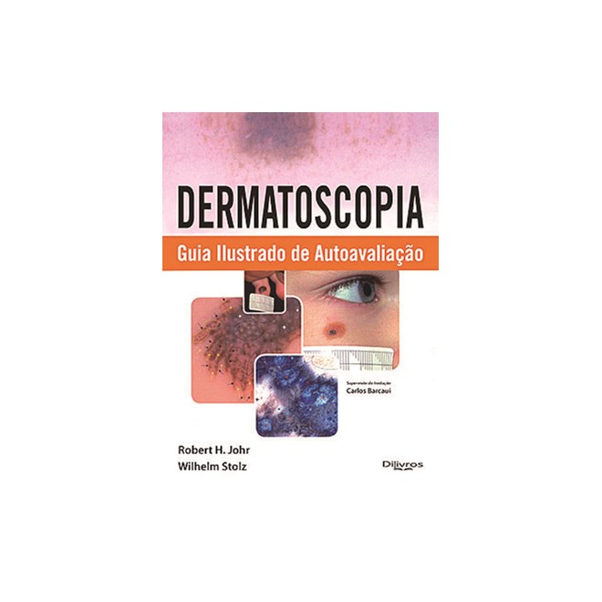 Livro - Dermatoscopia Guia Ilustrado de Autoavaliacao - Johr/stolz