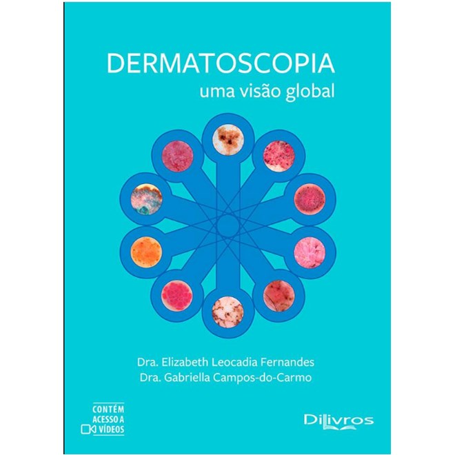 Livro Dermatoscopia: Uma Visão Global - Fernandes - Dilivros