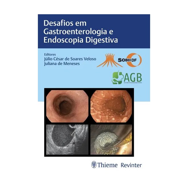Livro Desafios em Gastroenterologia e Endoscopia Digestiva - SOBED - Revinter