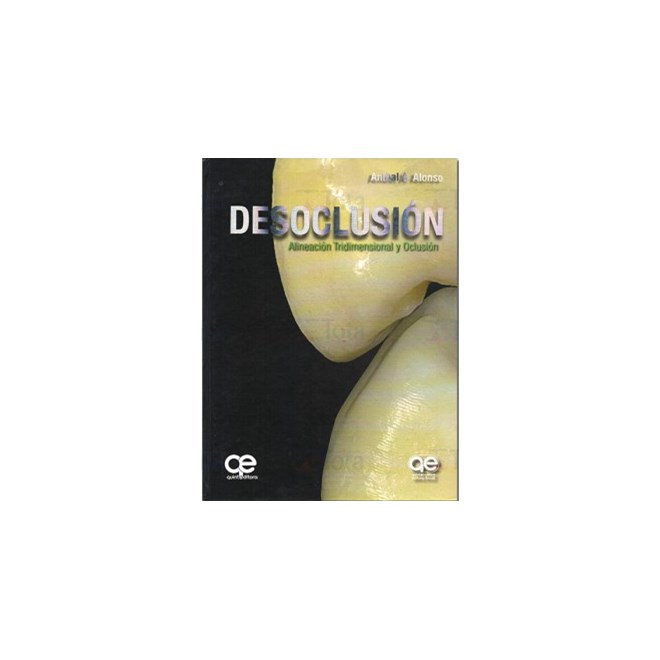 Livro - Desoclusion Alineacion Tridimensional Y Oclusion (espanhol) - Alonso